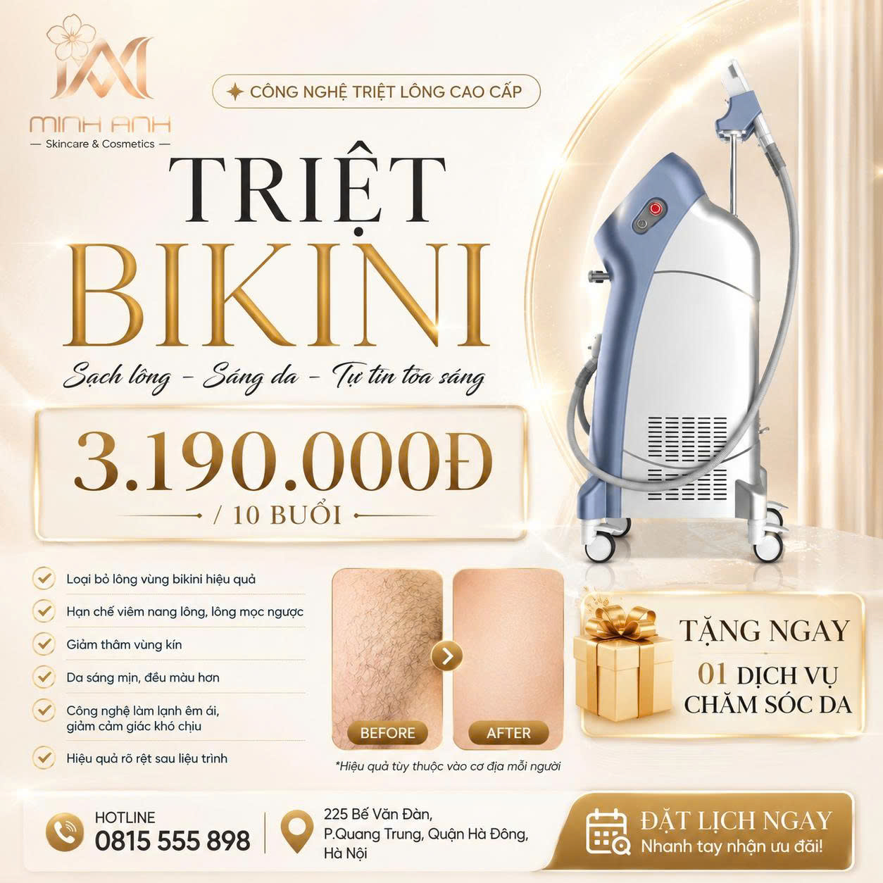 Triệt lông Bikini SHR tại Minh Anh Skin