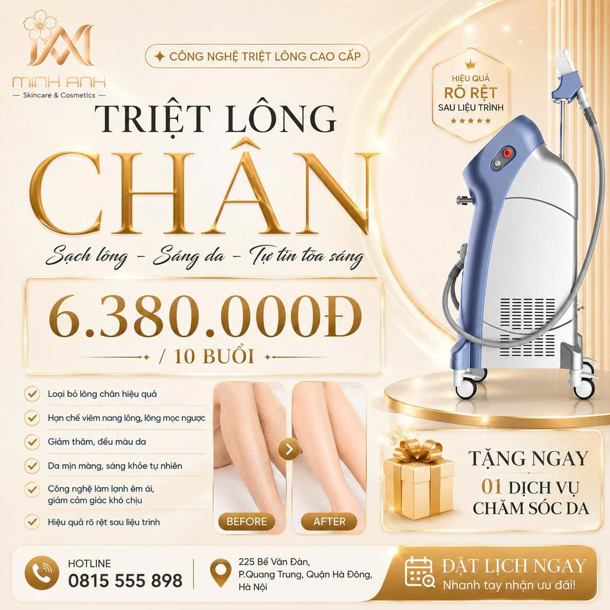 Triệt lông chân SHR tại Minh Anh Skin