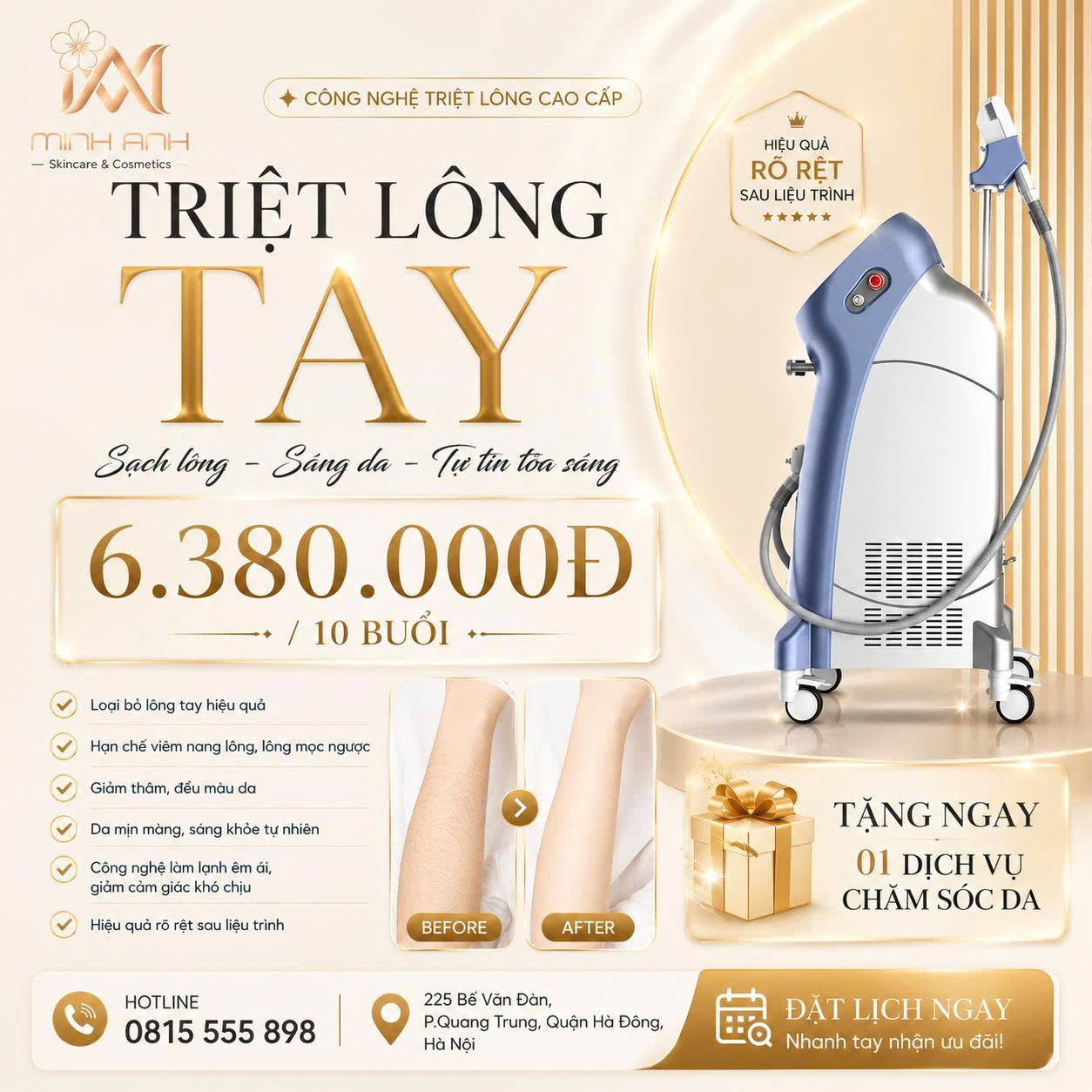 Triệt lông tay SHR tại Minh Anh Skin