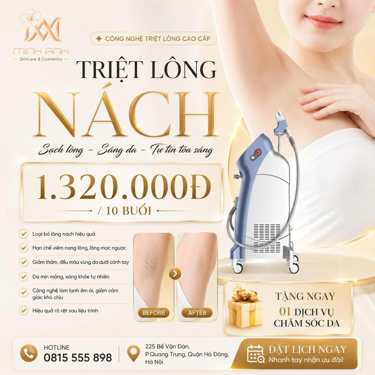 Triệt lông công nghệ cao cấp SHR tại Minh Anh Skin