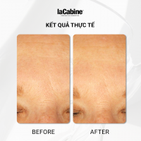 Serum Kem Pro Retinol 0.3%