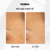 Serum Kem Niacinamide 15%