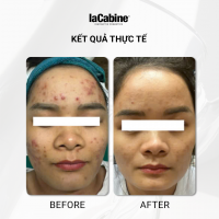 Serum Kem Prebiotic Complex 2%